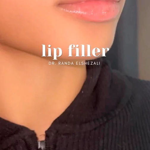 Symphony Clinic Dubai Instagram - beauty transformation